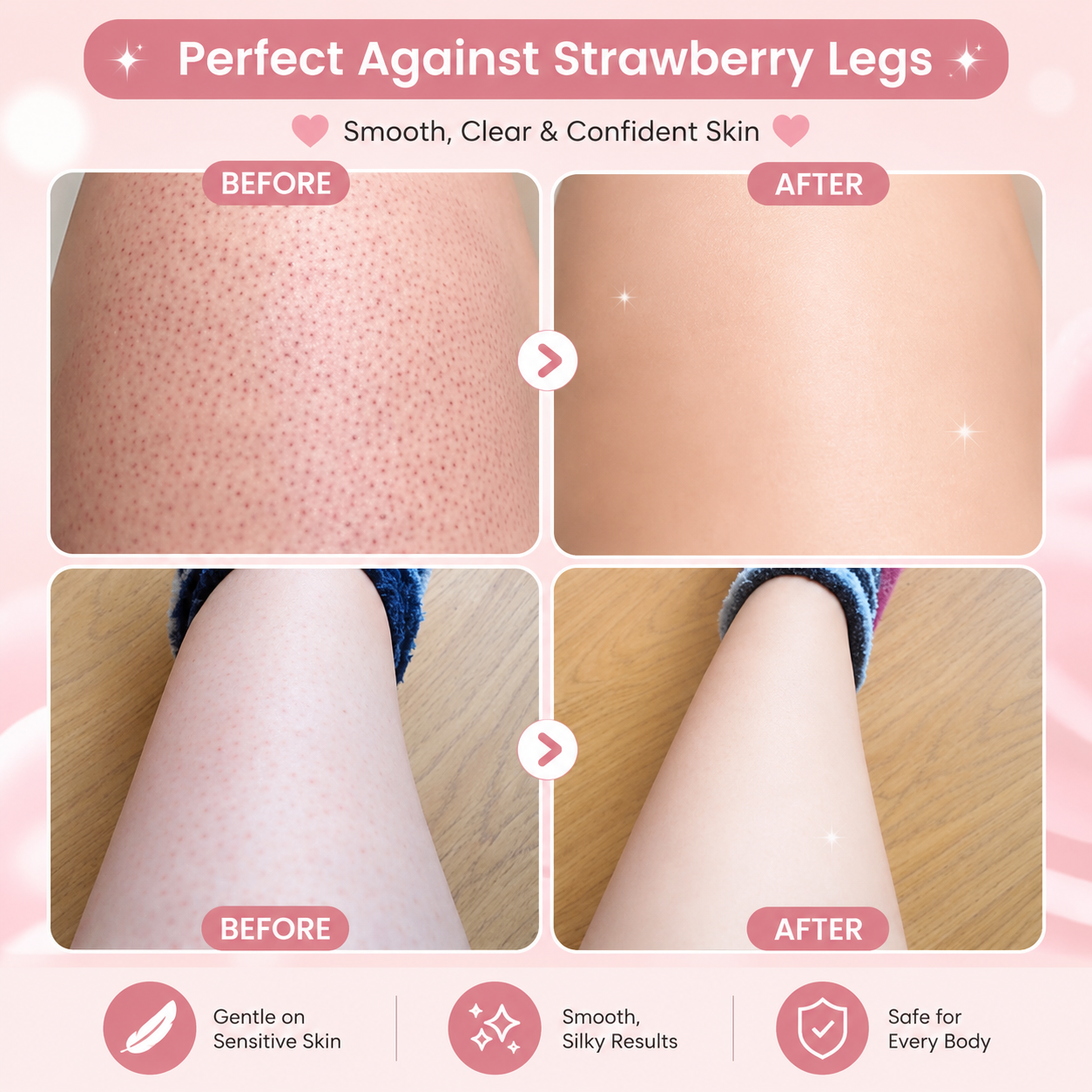 Perfect Touch™ Epilator
